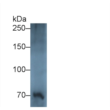 Multimerin 1 (MMRN1) Human Polyclonal Antibody