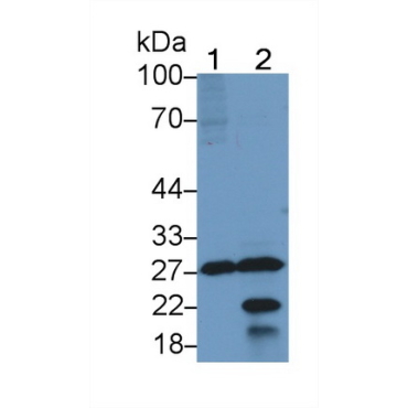 Molybdenum Cofactor Synthesis 1 (MOCS1) Mouse Polyclonal Antibody