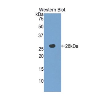 3-Mercaptopyruvate Sulfurtransferase (MST) Human Polyclonal Antibody