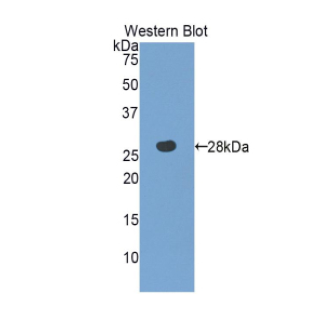 3-Mercaptopyruvate Sulfurtransferase (MST) Human Polyclonal Antibody