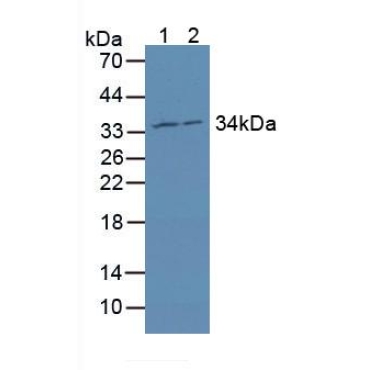 Mitochondrial Ribosomal Protein L1 (MRPL1) Human Polyclonal Antibody