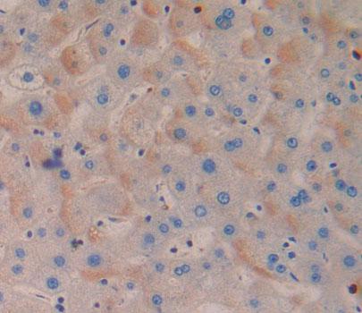 Mitochondrial Transcription Termination Factor (MTERF) Human Polyclonal Antibody