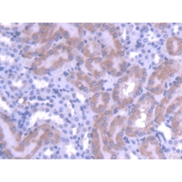 Metal Regulatory Transcription Factor 1 (MTF1) Mouse Polyclonal Antibody