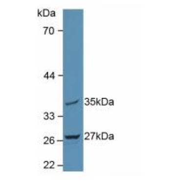 Mitochondrial Tumor Suppressor 1 (MTUS1) Human Polyclonal Antibody