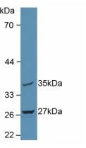 Mitochondrial Tumor Suppressor 1 (MTUS1) Human Polyclonal Antibody