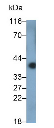 Metaxin 1 (MTX1) Mouse Polyclonal Antibody