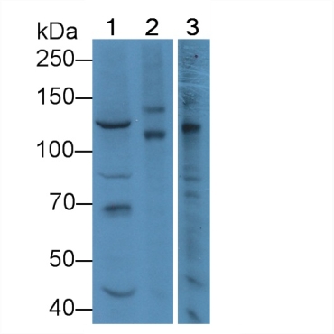 Myelin Transcription Factor 1 (MYT1) Human Polyclonal Antibody