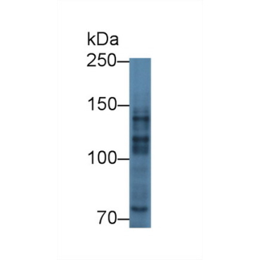 Myelin Transcription Factor 1 (MYT1) Mouse Polyclonal Antibody