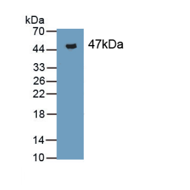 Microsomal Triglyceride Transfer Protein (MTTP) Mouse Polyclonal Antibody