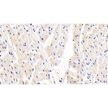 Dystrophia Myotonica Protein Kinase (DMPK) Human Polyclonal Antibody