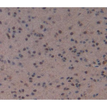 Myocyte Specific Enhancer Factor 2A (MEF2A) Mouse Polyclonal Antibody