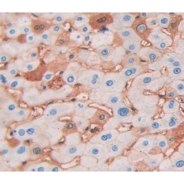 N-Ethylmaleimide Sensitive Factor Attachment Protein Alpha (NAPa) Human Polyclonal Antibody