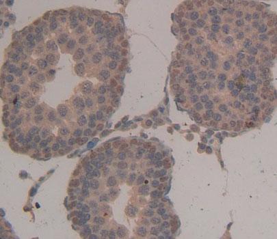 Nuclear Autoantigenic Sperm Protein, Histone Binding (NASP) Rat Polyclonal Antibody