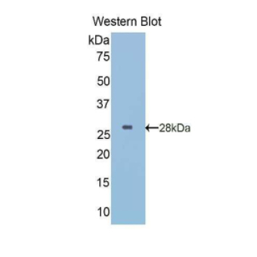 Insulin Like Growth Factor Binding Protein 5 (IGFBP5) Human Polyclonal Antibody