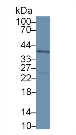 Nucleophosmin 1 (NPM1) Human Polyclonal Antibody