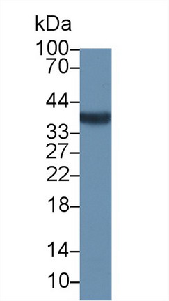 Nucleophosmin 1 (NPM1) Human Polyclonal Antibody