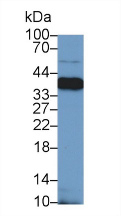 Nucleophosmin 1 (NPM1) Mouse Polyclonal Antibody