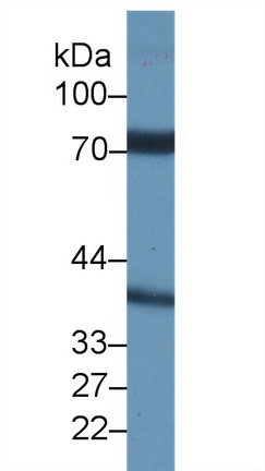 Nicastrin (NCSTN) Rat Polyclonal Antibody