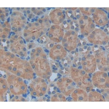 Purine Nucleoside Phosphorylase (PNP) Mouse Polyclonal Antibody