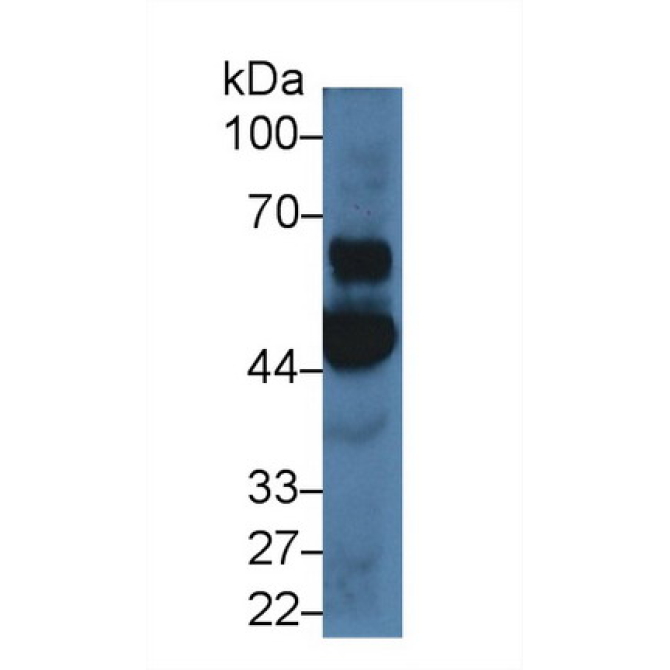 2',5'-Oligoadenylate Synthetase 1 (OAS1) Human Polyclonal Antibody