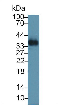 Osteoglycin (OGN) Human Polyclonal Antibody