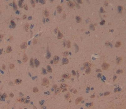 Oligophrenin 1 (OPHN1) Rat Polyclonal Antibody