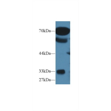 Osteosarcoma Amplified 9 (OS9) Human Polyclonal Antibody