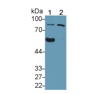 Oxysterol Binding Protein (OSBP) Human Polyclonal Antibody
