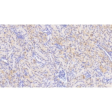 Osteopetrosis Associated Transmembrane Protein 1 (OSTM1) Human Polyclonal Antibody