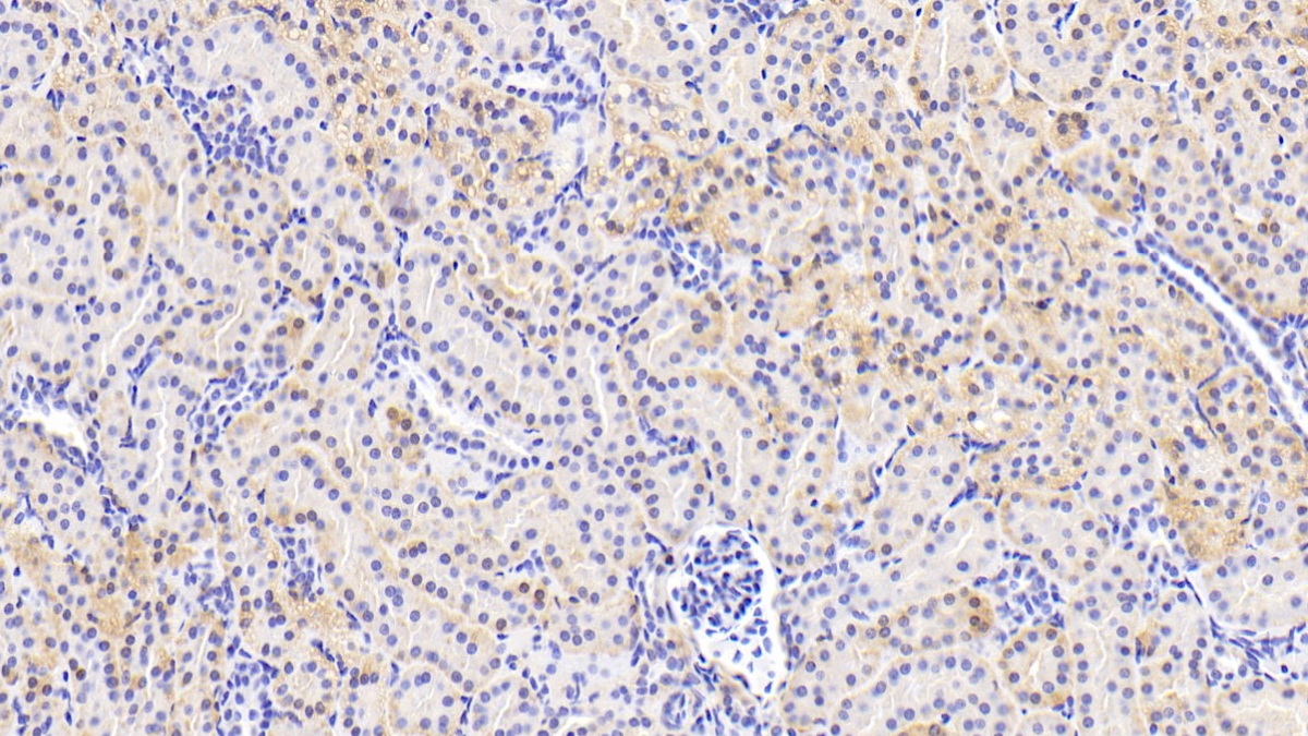 Osteopetrosis Associated Transmembrane Protein 1 (OSTM1) Human Polyclonal Antibody