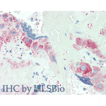 Anoctamin 2 (ANO2) Human Polyclonal Antibody