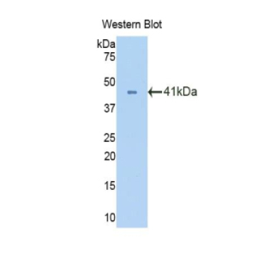 Oxytocin Receptor (OXTR) Human Polyclonal Antibody