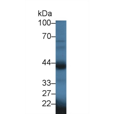 Oxytocin Receptor (OXTR) Mouse Polyclonal Antibody