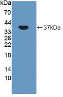 Oxytocin Receptor (OXTR) Rat Polyclonal Antibody