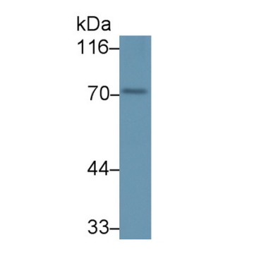 Peptidyl Arginine Deiminase Type I (PADI1) Human Polyclonal Antibody