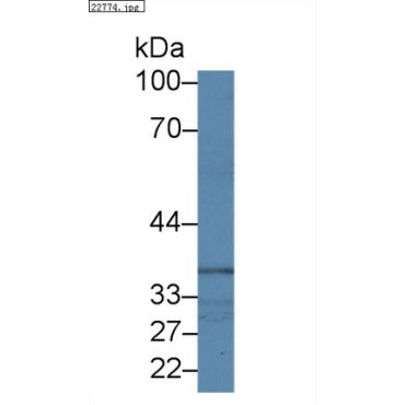 Cytoplasmic Protein NCK1 (NCK1) Human Polyclonal Antibody