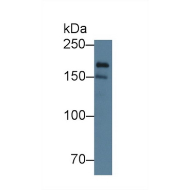 Polymerase DNA Directed Alpha 1 (POLa1) Human Polyclonal Antibody