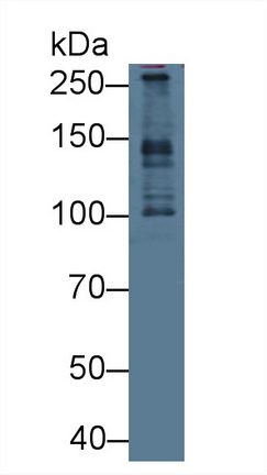 Pericentriolar Material 1 (PCM1) Human Polyclonal Antibody