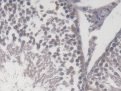 Pericentriolar Material 1 (PCM1) Rat Polyclonal Antibody