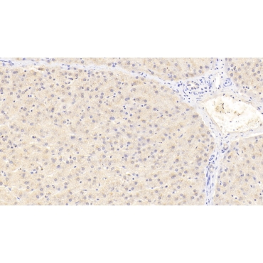 Pericentrin (PCNT) Human Polyclonal Antibody