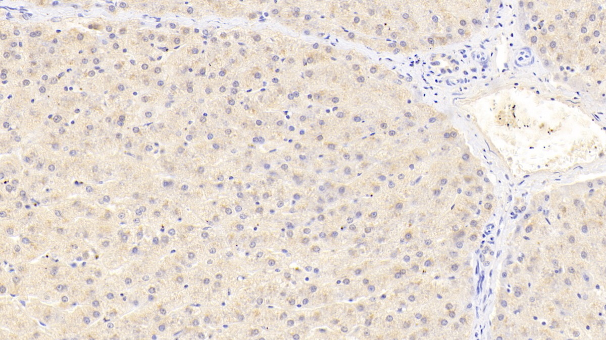 Pericentrin (PCNT) Human Polyclonal Antibody
