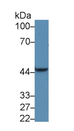 Pyruvate Dehydrogenase Kinase Isozyme 1 (PDK1) Human Polyclonal Antibody