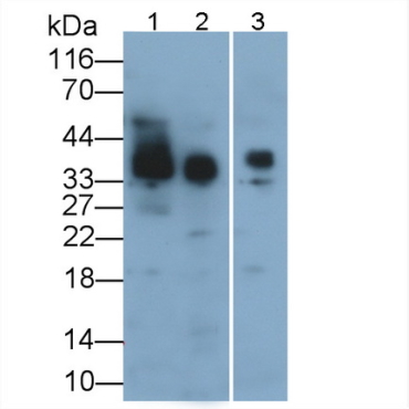 Podoplanin (PDPN) Human Polyclonal Antibody