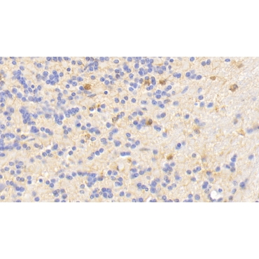 Twinkle Protein, Mitochondrial (TWINL) Human Polyclonal Antibody