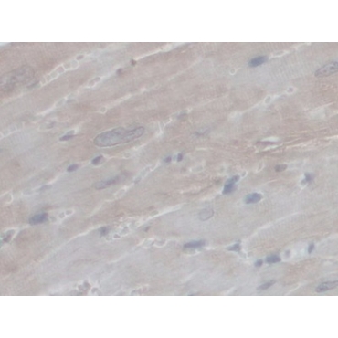 Peroxisomal Biogenesis Factor 1 (PEX1) Mouse Polyclonal Antibody