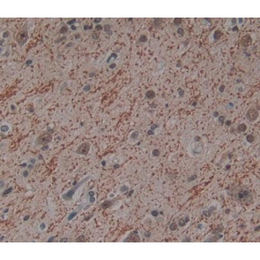 Phosphatidylinositol Transfer Protein Beta (PITPNb) Human Polyclonal Antibody