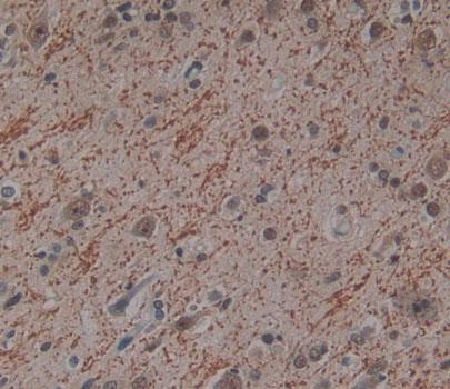 Phosphatidylinositol Transfer Protein Beta (PITPNb) Human Polyclonal Antibody