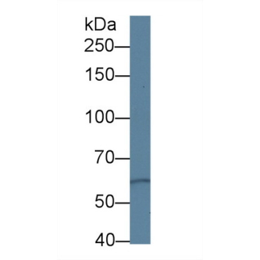 Protein Kinase D3 (PKD3) Human Polyclonal Antibody