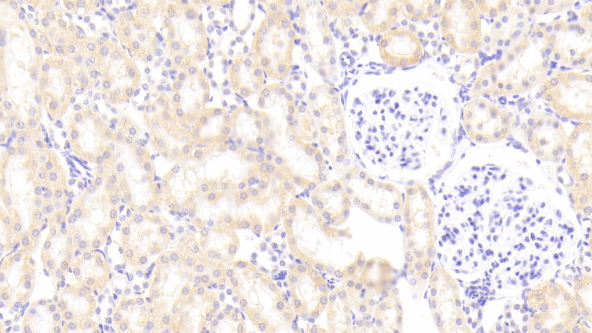 Phospholipid Transfer Protein (PLTP) Rat Polyclonal Antibody