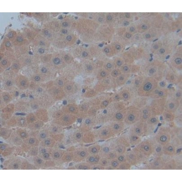 Phosphomannomutase 1 (PMM1) Human Polyclonal Antibody